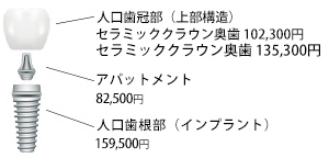 料金内訳