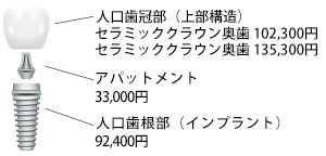 料金内訳